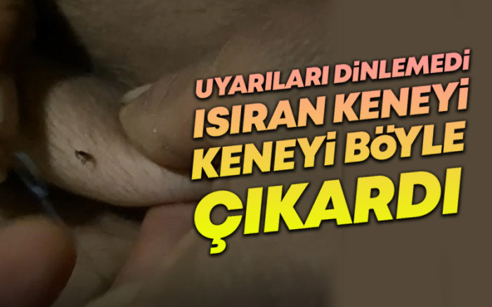 Uyarıları Dinlemeyen Vatandaş Keneyi Kendisi Çıkardı