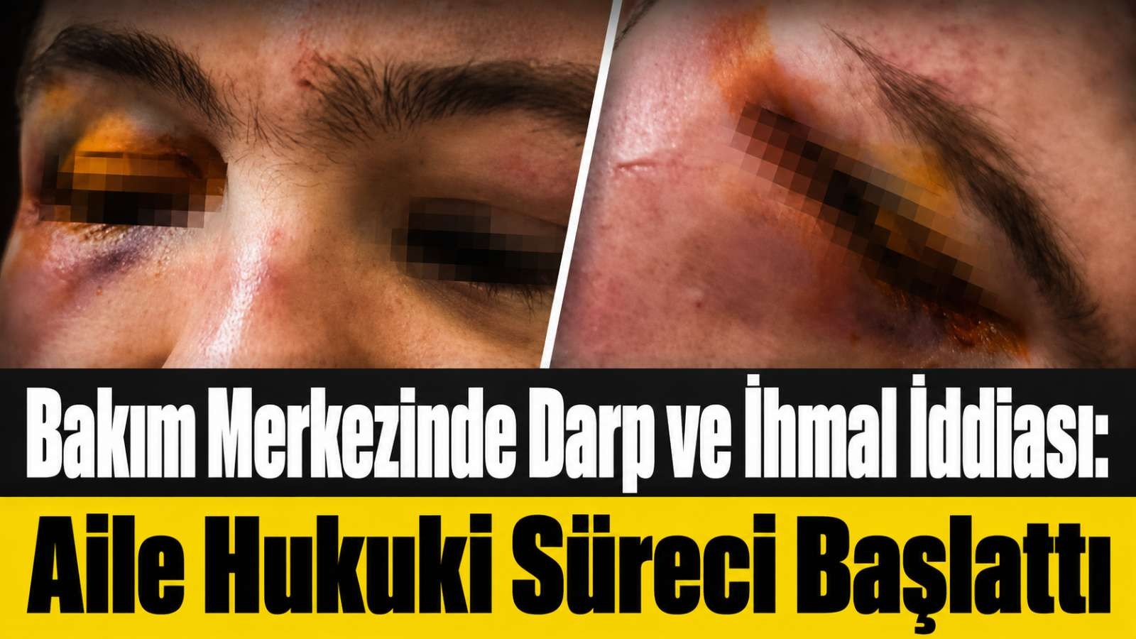 Bakım Merkezinde Darp ve İhmal İddiası: Aile Hukuki Süreci Başlattı