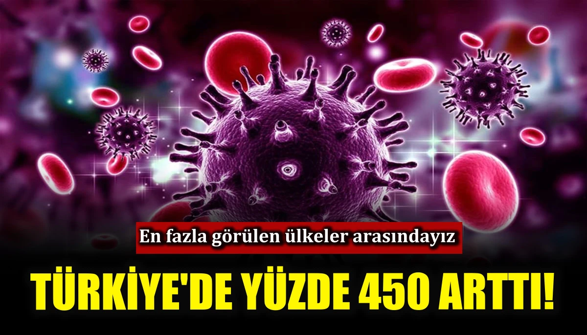 HIV enfeksiyonu Türkiye'de yüzde 450 arttı!
