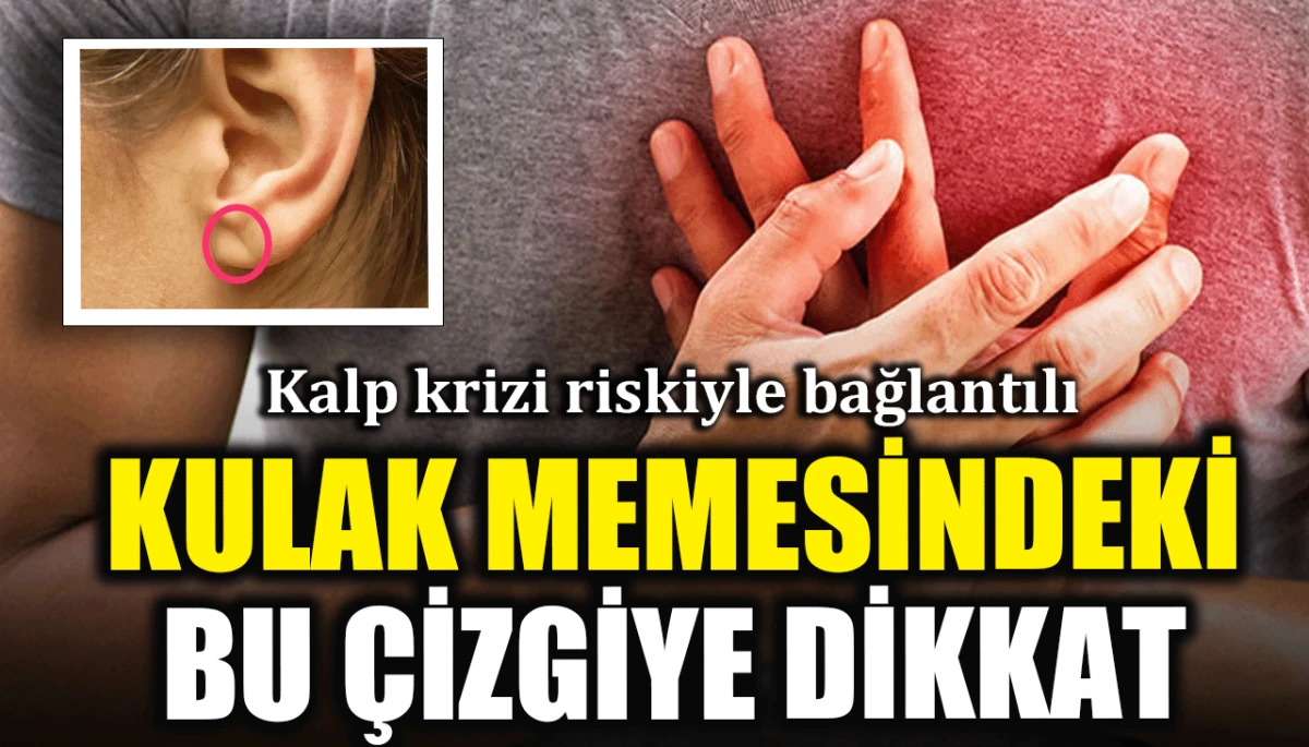 Kalp krizi riskiyle bağlantılı: Kulak memesindeki bu çizgiye dikkat