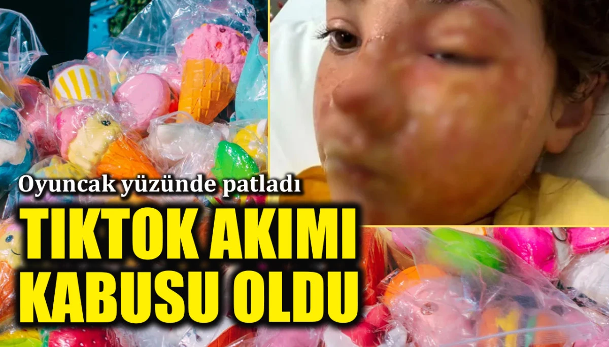 Oyuncak yüzünde patladı: TikTok akımı kabusu oldu