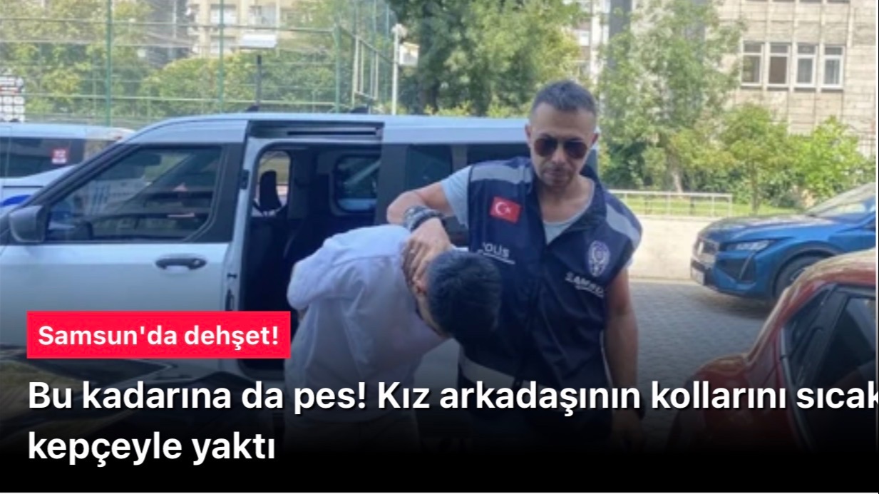  Kız arkadaşının kollarını yaktı