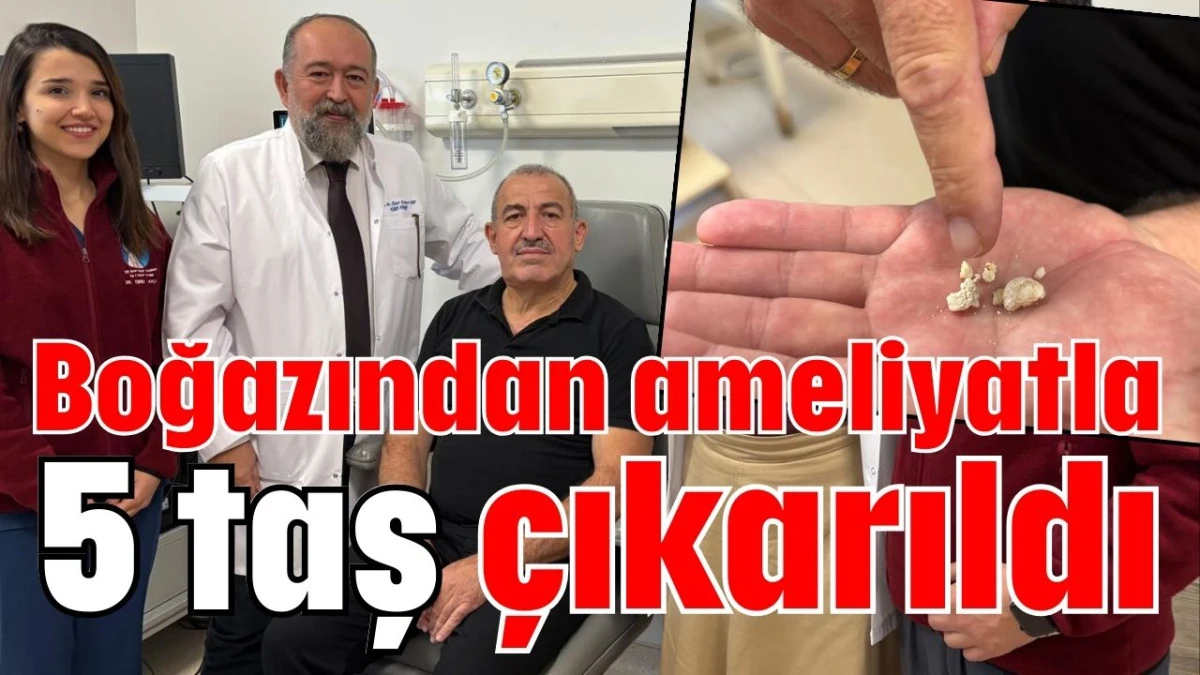 Boğazından ameliyatla 5 taş çıkarıldı 