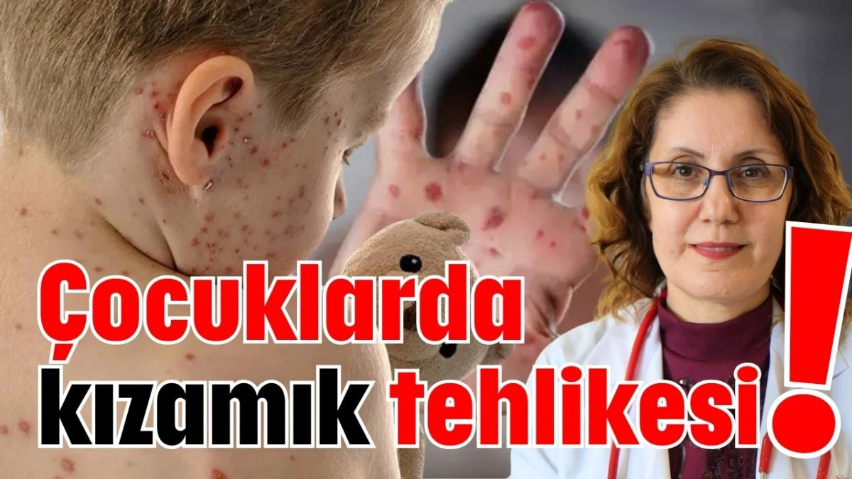 Çocuklarda kızamık tehlikesi!