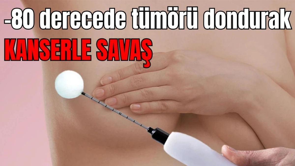 -80 derecede tümörü dondurarak kanserle savaş
