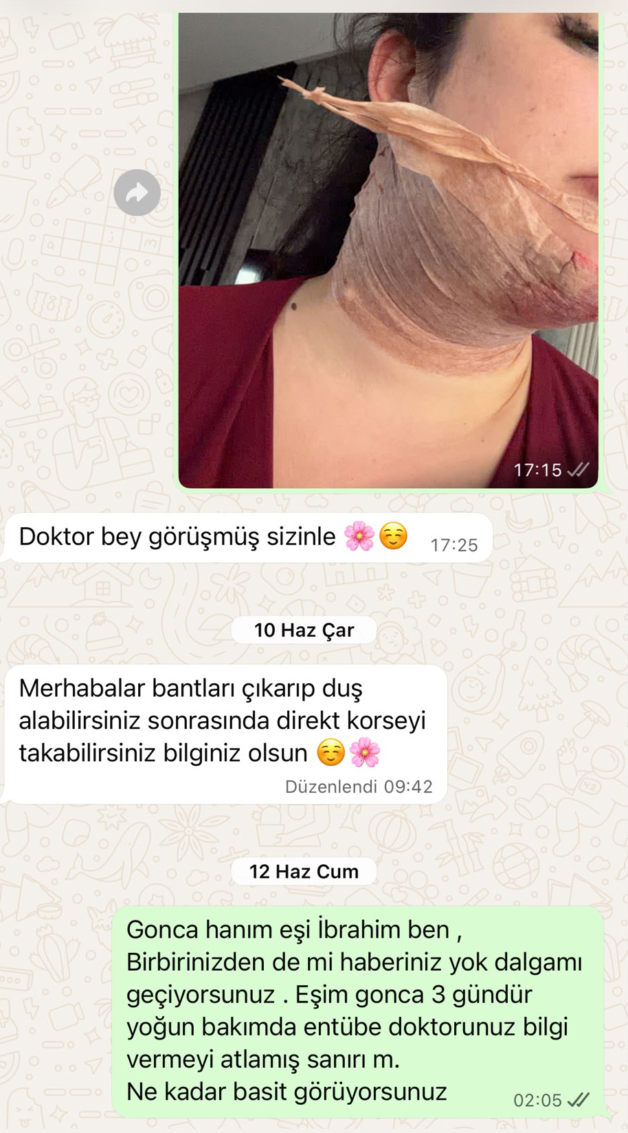 estetik-ameliyati-sonrasi-yogun-bakimda-1490717443514-120908