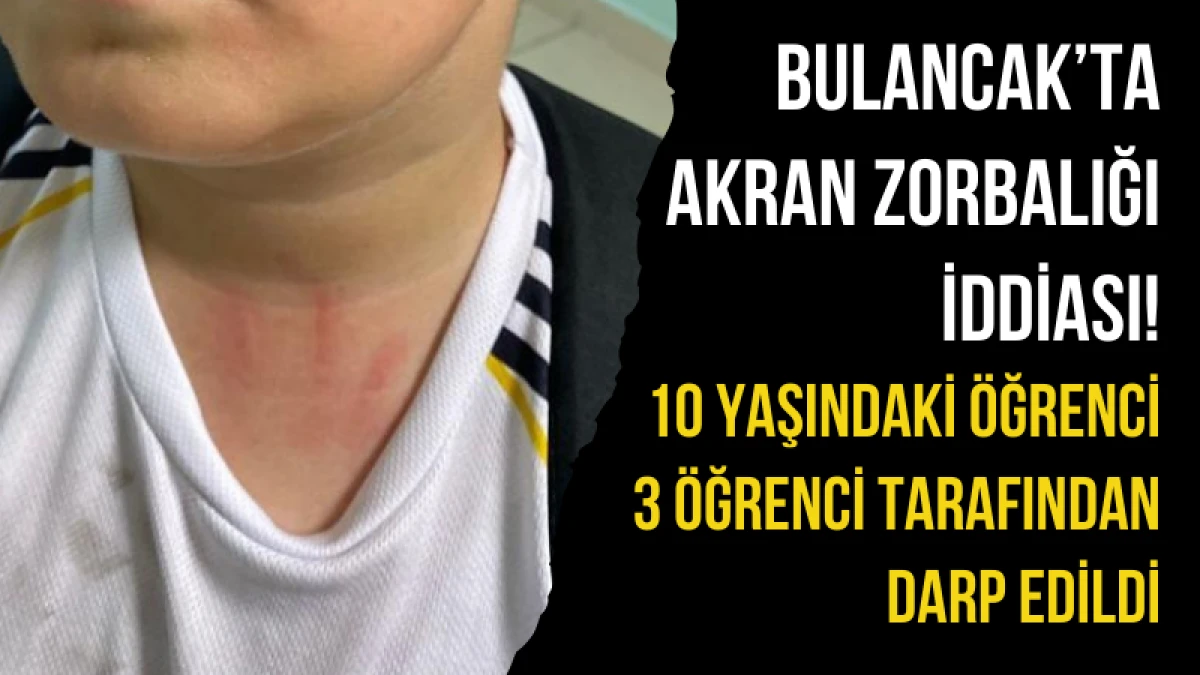 10 yaşındaki öğrenci 3 öğrenci tarafından darp edildi