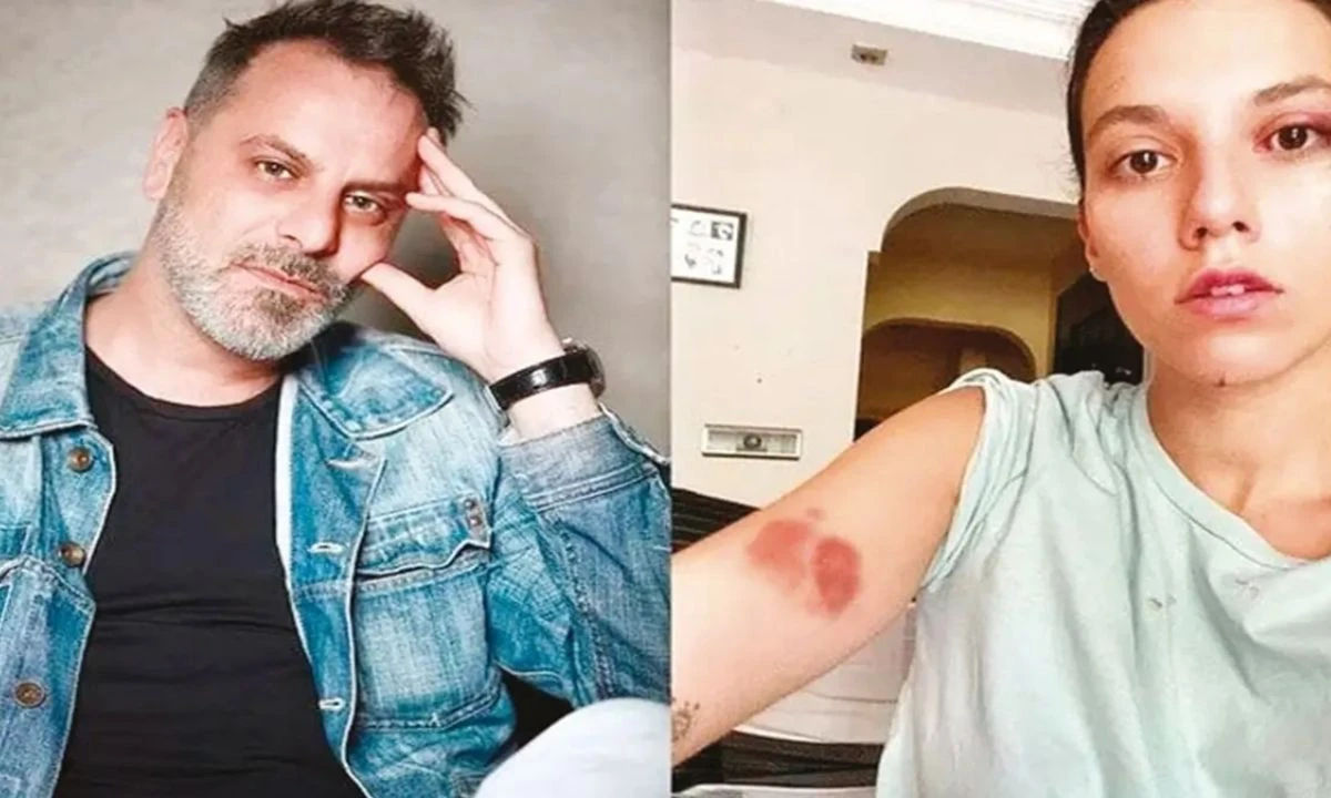 Oyuncu Ozan Güven ‘Yaralama'ya 2 yıl hapis! Karar onanırsa cezaevine girecek