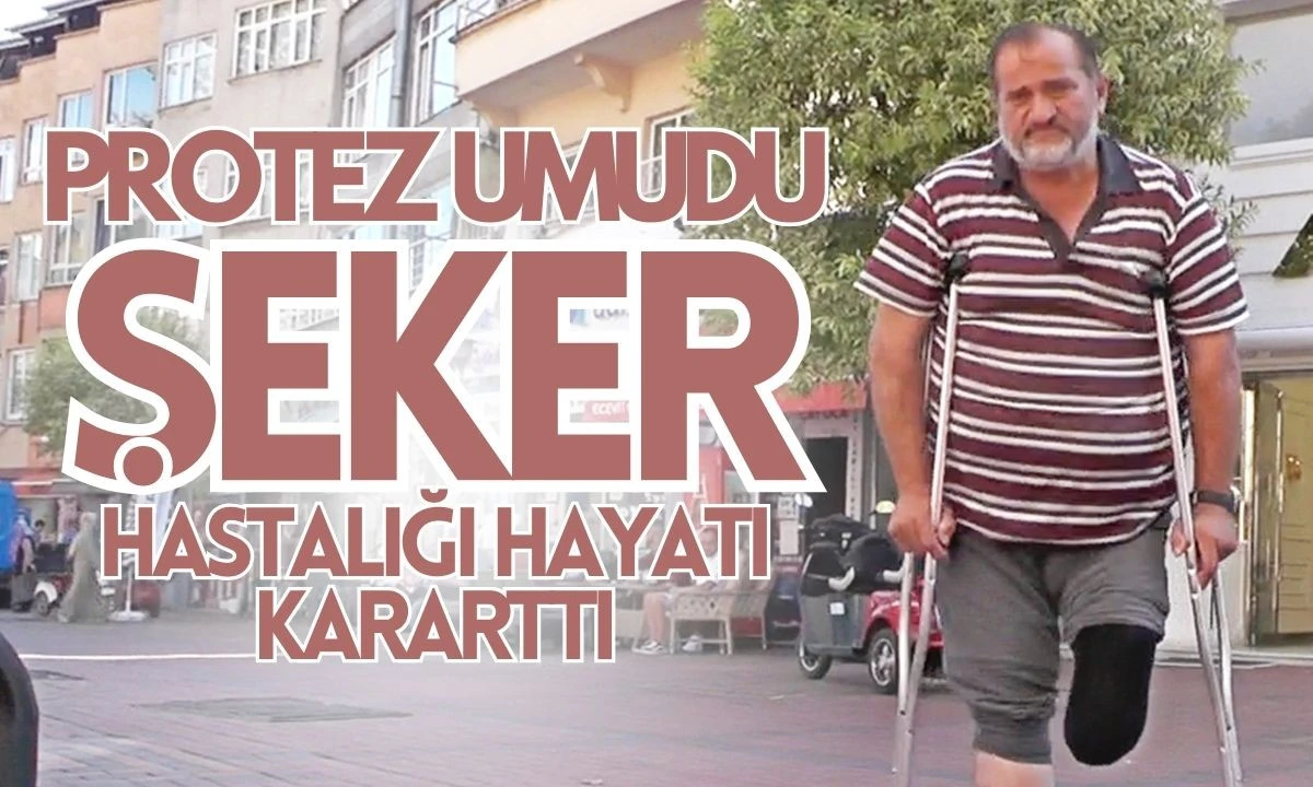 52 yaşında protez umudu: Şeker hastalığı hayatı kararttı