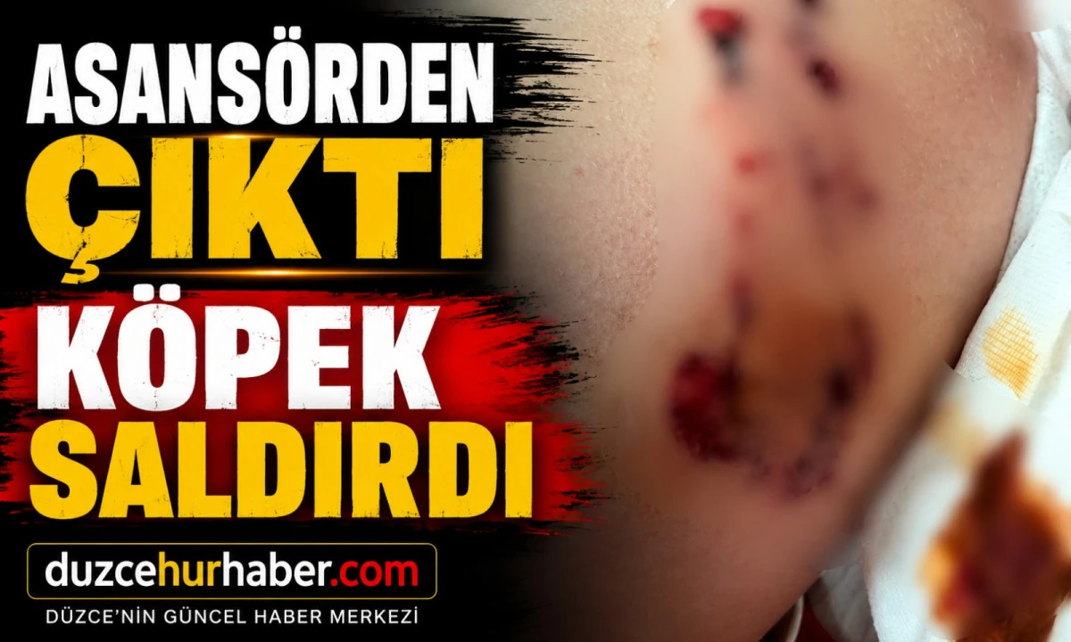 7 Yaşındaki Çocuğa Köpek Saldırdı! Savunması Tepki Çekti
