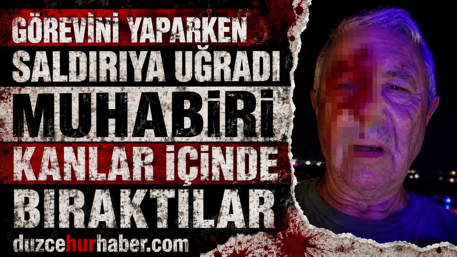 Haber Yapmaya Gitti, Saldırıya Uğradı: Muhabir Kanlar İçinde Kaldı