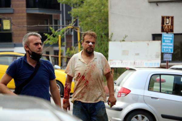 Zonguldak'ta acemi kasaplar hastanelik oldu, 1 kişinin parmağı koptu