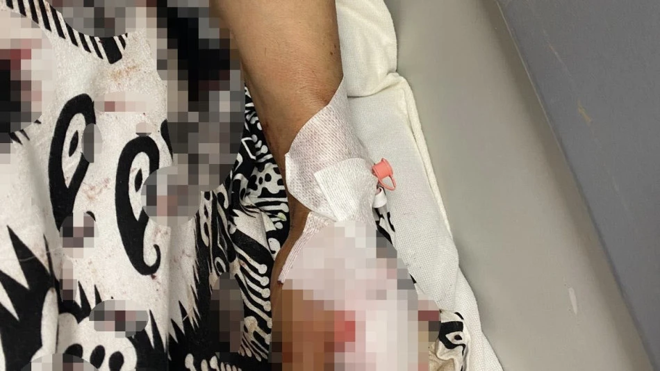 Kartepe’de köpek dehşeti