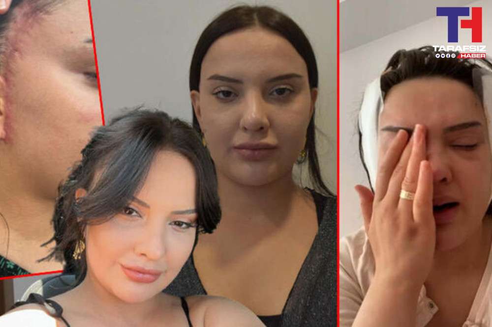 Yaptırdığı Estetik Operasyonlar Hayatını Kararttı